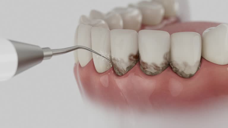 Trusted Tooth Extraction service in Dumbarton, VA - Dentist Open Now